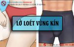 Lở loét vùng kín là bệnh gì?