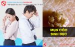 Mụn cóc sinh dục – dễ lây, khó phòng