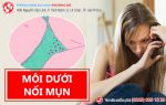 “Làm chuyện người lớn” bị nổi mụn môi dưới