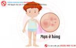 Tổng quan về tình trạng nổi mụn ở háng của nam và nữ