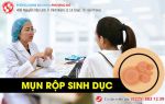 Dấu hiệu mụn rộp sinh dục như thế nào?