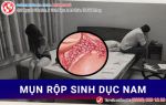 “Yêu” kém an toàn, cẩn trọng mụn rộp sinh dục nam