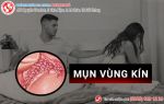 Nổi mụn vùng kín chi chít vì mê “rau sạch”