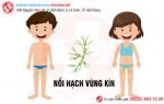 Nổi hạch vùng kín ở nam và nữ là bệnh gì?