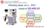 Từ A – Z thông tin phương pháp ALA – PDT hỗ trợ điều trị sùi mào gà