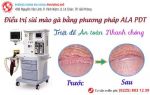 Hoang đường chuyện chữa sùi mào gà một lần là khỏi