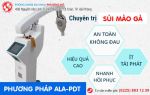 Hết lo lắng sùi mào gà ở họng nhờ phương pháp này