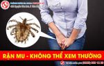 Sự thật đáng kinh ngạc về rận mu