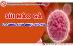 Tất cả thông tin xoay quay thắc mắc sùi mào gà chữa được không?