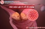 Sùi mào gà ở cổ tử cung – rất khó có thể nhận biết