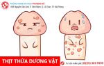 Nam giới cần cảnh giác với thịt thừa dương vật