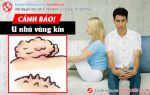 U nhú vùng kín – tưởng không hại mà hại không tưởng