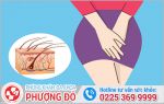 Nổi mụn lông mu ở nữ