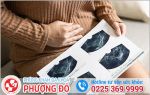 Siêu âm bàng quang ở nữ chẩn đoán được bệnh lý nào?