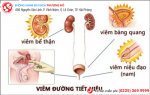 Tổng quan về viêm đường tiết niệu ở cả nam và nữ giới