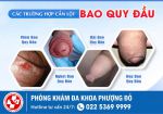 Có Nên Tự Lột Bao Quy Đầu Tại Nhà Không?