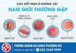 Nam Giới Nổi Mụn Dương Vật Cần Làm Gì? Đừng Để Bệnh Âm Thầm Tiến Triển!