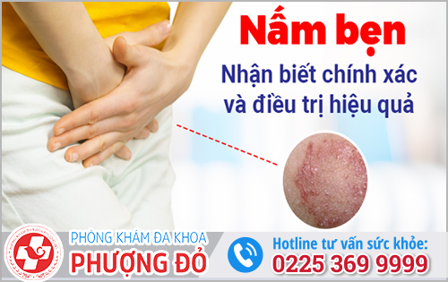 Nấm Bẹn Nữ Giới Nguyên Nhân Và Cách Điều Trị