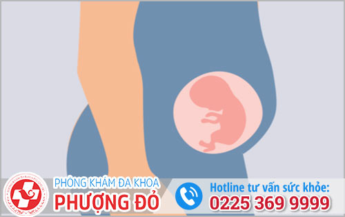 Thai 20 Tuần Có Phá Được Không?