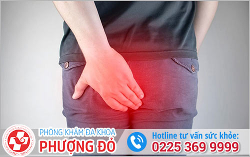 Bệnh Trĩ Để Lâu Có Sao Không?