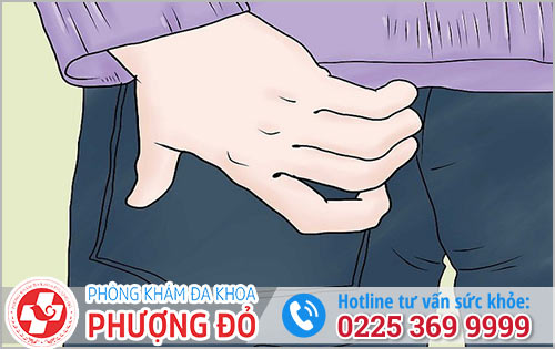 Hậu Môn Nổi Cục Cứng Là Bệnh Gì?