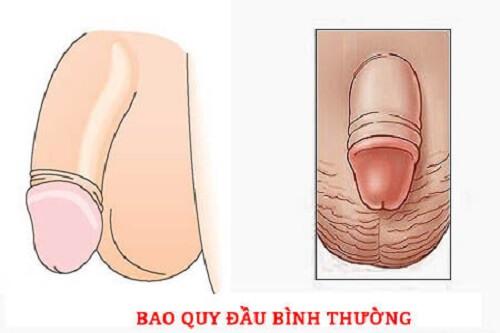  Hình ảnh bao quy đầu bình thường ở người lớn: Nhận biết và Phân biệt