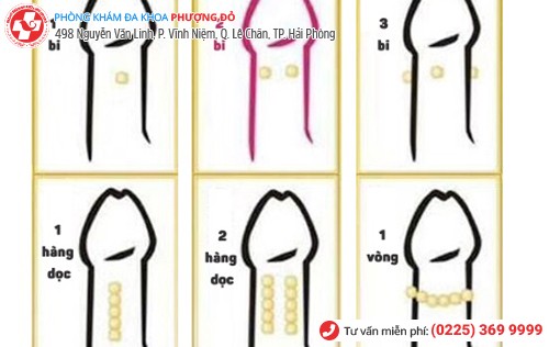 các kiểu gắn bi dương vật