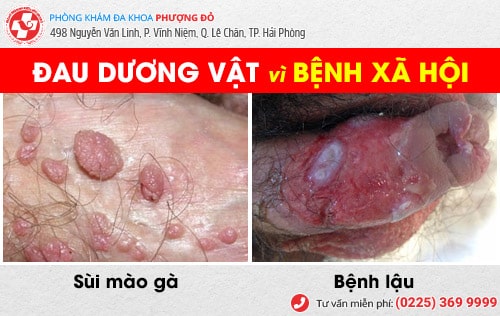 đau dương vật do bệnh lý đau dương vật do bệnh lý