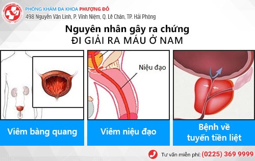 Đi giải đau, có máu là bệnh gì? Có nguy hiểm không?