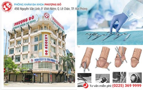 Đa Khoa Phượng Đỏ - địa chỉ cắt bao quy đầu uy tín Đa Khoa Phượng Đỏ - địa chỉ cắt bao quy đầu uy tín