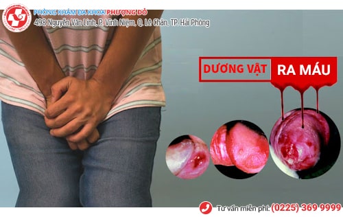 Dương vật ra máu là bị bệnh gì? Dương vật ra máu là bị bệnh gì?