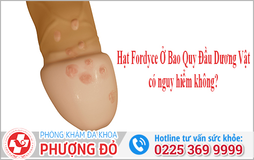 Hạt Fordyce Ở Bao Quy Đầu Dương Vật Có Nguy Hiểm Không?