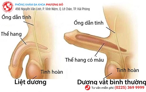 biến chứng rối loạn cương dương