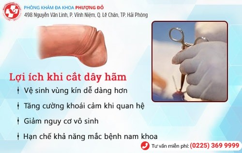 Nên cắt dây hãm quy đầu khi nào? Giải đáp chi tiết bác sĩ chuyên khoa Nên cắt dây hãm quy đầu khi nào? Giải đáp chi tiết bác sĩ chuyên khoa