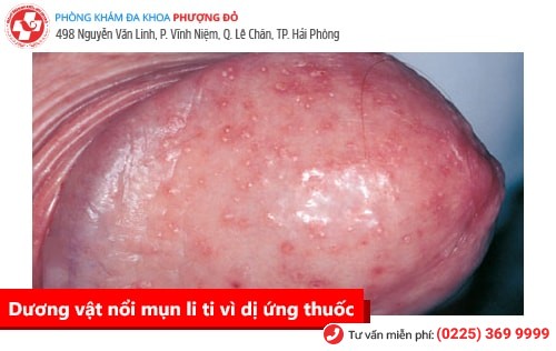 Nỗi đau thầm kín mang tên xuất tinh sớm Nỗi đau thầm kín mang tên xuất tinh sớm