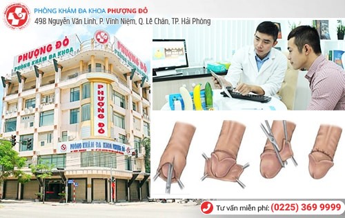 phòng khám cắt bao quy đầu phòng khám cắt bao quy đầu