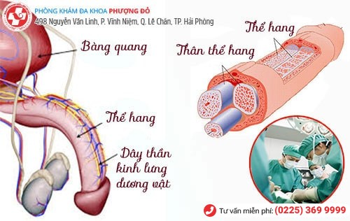 Phương pháp chặn dây thần kinh lưng dương vật Phương pháp chặn dây thần kinh lưng dương vật