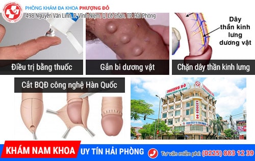 thuốc làm to dương vật pk-duong-do.jpg