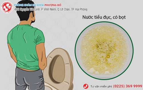 Thuốc trị bàng quang có những loại nào tốt?