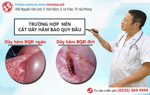 Nên cắt dây hãm quy đầu khi nào? Giải đáp chi tiết bác sĩ chuyên khoa Nên cắt dây hãm quy đầu khi nào? Giải đáp chi tiết bác sĩ chuyên khoa