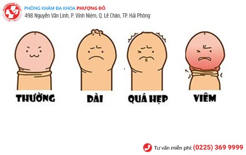 vấn đề bao quy đầu
