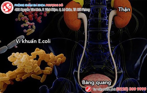 triệu chứng viêm đường tiết niệu triệu chứng viêm đường tiết niệu