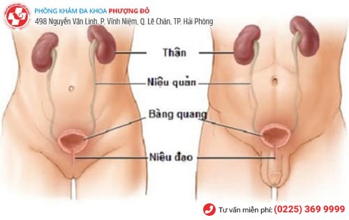viêm đường tiết niệu