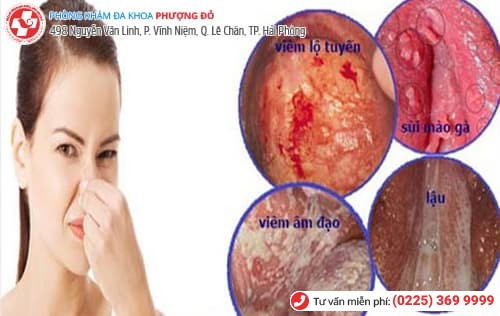 âm đạo bị hôi