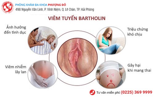 ảnh hưởng viêm tuyến bartholin