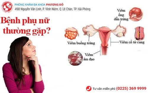 Những bệnh phụ nữ thường gặp 