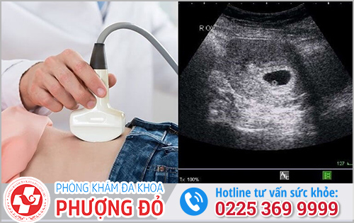 Những điều cần lưu ý khi phá thai 4 tuần