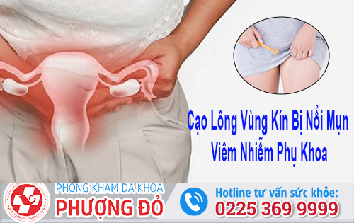 Cạo Lông Vùng Kín Bị Nổi Mụn Viêm Nhiễm Phụ Khoa