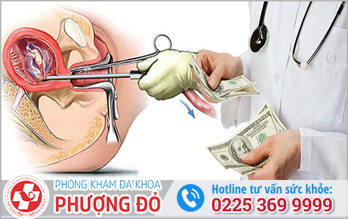 Chi phí nong – gắp thai