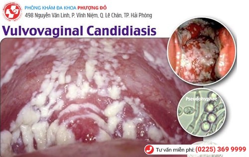 Đau bộ phận sinh dục nữ là bị làm sao? Có nguy hiểm không? Đau bộ phận sinh dục nữ là bị làm sao? Có nguy hiểm không?